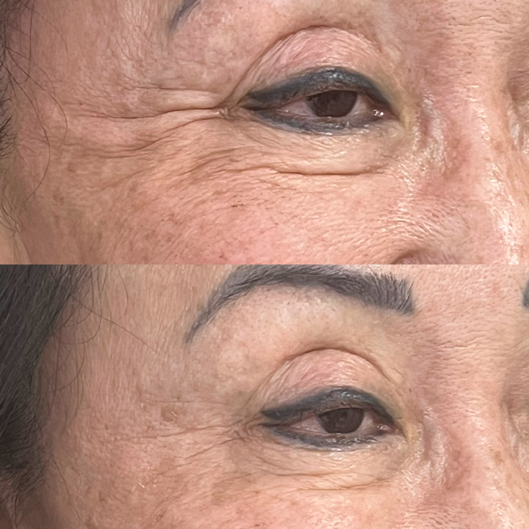 Caso 04 - Antes e depois Madoka