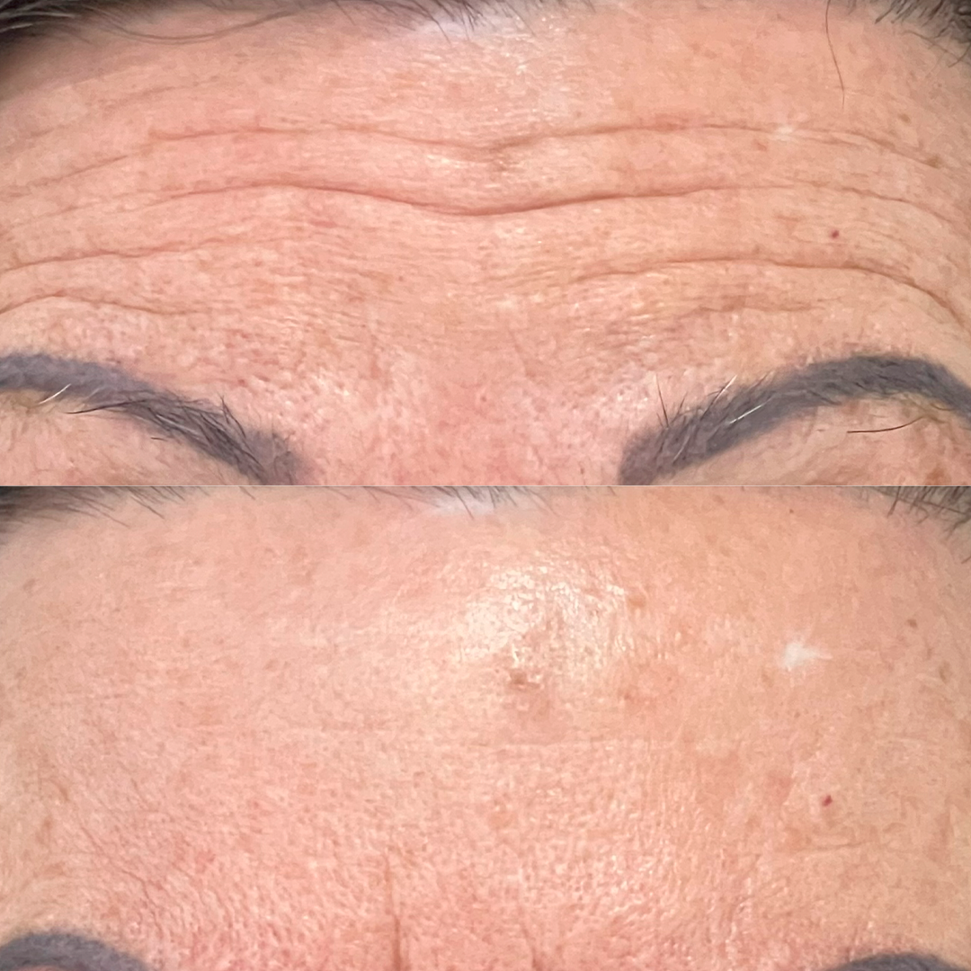 Caso 05 - Antes e depois Madoka