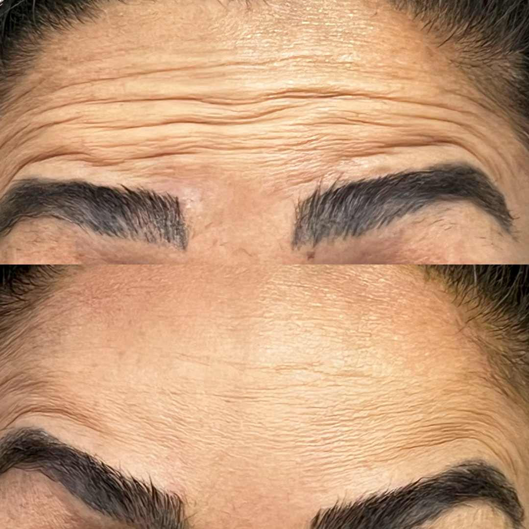 Caso 06 - Antes e depois Madoka