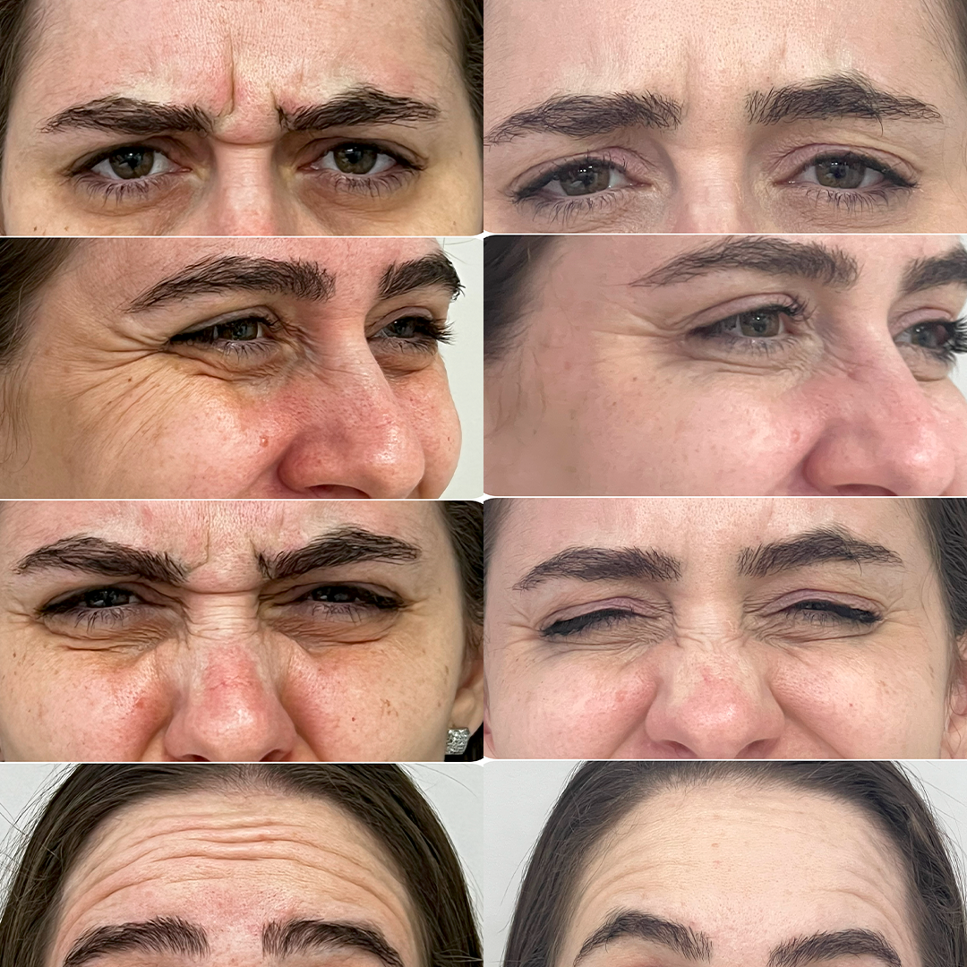 Caso 01 - Antes e depois Madoka